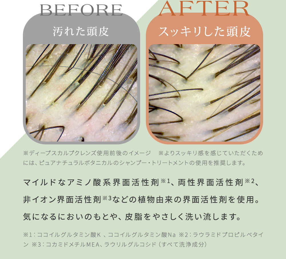 マイルドなアミノ酸系界面活性剤※1、両性界面活性剤※2、非イオン界面活性剤※3などの植物由来の界面活性剤を使用。気になるにおいのもとや、皮脂をやさしく洗い流します。